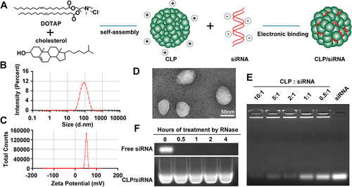 Figure 1 Preparation and characterization of the CLP/siRNA complex. (A) Preparation strategy. (B) Size distribution of CLP detected by particle sizer. (C) Zeta potential of CLP. (D) Transmission electron microscopy image of CLP. (E) Gel retardation assay of the CLP/siRNA complex. (F) siRNA degradation assay by agarose gel electrophoresis.