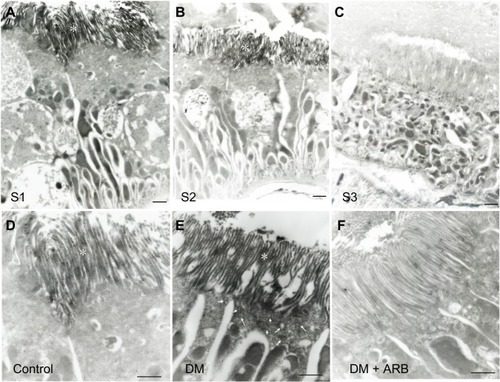 Figure 2 Pre-embedding immuno-electron microscopy for SGLT2.