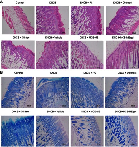 Figure 6 Histological features of the skin treated with different formulations in AD mouse model. The sections were stained with hematoxylin and eosin (A) and toluidine blue (B), respectively.Abbreviations: AD, atopic dermatitis; DNCB, 1–chloro–2,4–dinitrobenzene; FK506, tacrolimus; Control, healthy mice with shaved dorsal region; DNCB, AD-induced mice without drug treatment; DNCB + PC, AD-induced mice treated with propylene carbonate containing 0.1% (w/v) FK506; DNCB + Ointment; AD-induced mice treated with commercial ointment containing 0.1% (w/w) FK506; DNCB + Oil free; AD-induced mice treated with Oil free containing 0.1% (w/v) FK506; DNCB + Vehicle, AD-induced mice treated with microemulsion based on menthol/camphor eutectic vehicle without FK506; DNCB + MCE ME, AD-induced mice treated with microemulsion based on menthol/camphor eutectic containing 0.1% (w/v) FK506; DNCB + MCE ME gel, AD-induced mice treated with microemulsion based on menthol/camphor eutectic gel containing 0.1% (w/w) FK506.