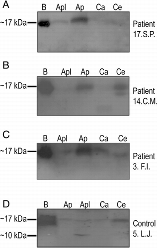 Figure 1. Immunoblot analysis. Extracts of plants evoking cross-reactivity were probed with sera from patients and control subjects; selection of immunoblots. (A) Patient 17. S.P., (B), patient 14. C.M., (C), patient 3. F.I., (D), control subject 5. L.J. Bi, extract from birch pollen. Apl, extract from apple peels; Ap, extract from apple pulp; Ca, extract from carrot; Ce, extract from celery. Other details as described in Methods section.