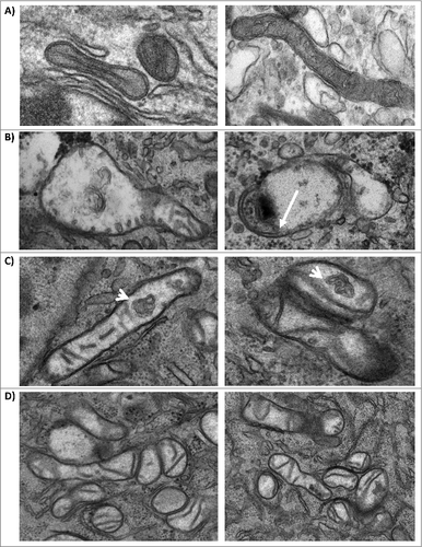 Figure 7. Mitochondria display structural alterations in infected cells. (A) TEM images of uninfected U87MG cells. TEM images of TC-83 infected cells displaying: (B) heterogeneously swollen mitochondria; (C) structural alterations, including membranous structures in the interior of mitochondria (arrows) that did not appear to have connections with the inner cristae; and (D) mitochondrial clusters