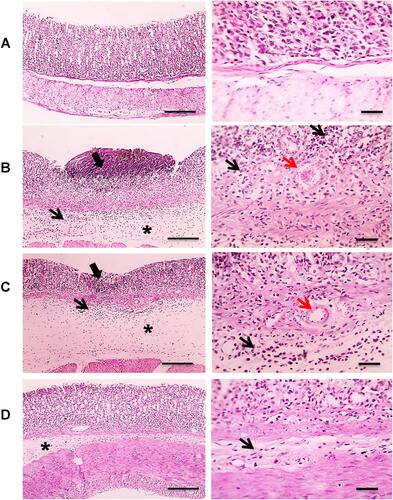 Figure 11 Microscopic pictures of H&E-stained rats’ stomachs: (A) The control group showing normal glandular gastric mucosa. (B) The untreated positive control group induced by indomethacin showing large area of mucosal necrosis and ulceration (thick black arrow) associated with marked submucosal edema (*), congestion (red arrow), and leukocytic cells infiltration (black arrow). (C) The treated group with BRFE (150 mg/kg) showing small area of mucosal necrosis and ulceration (thick black arrow) associated with milder submucosal edema (*), congestion (red arrow), and leukocytic cells infiltration (black arrow). (D) The treated group with BRFE (300 mg/kg) showing very mild submucosal edema (*) and very few leukocytic cells infiltration (black arrow). The left panel is with low magnification X: 100 bar 100 and the right panel is with high magnification X: 400 bar 50.