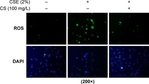 Figure 4 ROS fluorescence in 16HBE cells.Notes: 16HBE cells were stimulated with 2% CSE and/or Cordyceps sinensis (100 mg/L) for 24 hours, and stained with ROS fluorescence. Results represent three independent experiments.Abbreviations: CSE, cigarette smoke extract; DAPI, 4′,6-diamidino-2-phenylindole; HBE, human bronchial epithelial; ROS, reactive oxygen species.