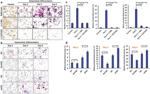 Figure 3. Induction of KLF2 and reduction of autophagy inhibited osteoclastic differentiation. (a) TRAP staining was performed to determine differentiated osteoclasts from RAW264.7 cells in presence or absence of 3-MA (an autophagy inhibitor), or GGTI298 (a KLF2 inducer) during the course of osteoclastic differentiation. Undifferentiated cells were used as a control. (b) TRAP+ cells were visualized in Klf2 overexpressed (Ad-Klf2/EV) or Klf2 knockdown (NS or siKlf2) RAW264.7 cells during the course of osteoclast differentiation.(c) Bar graphs showing the cumulative data in percentage of TRAP+ cells present per high power field of image. Each experiment was performed at lest 3 times and 15 fields were counted/experiments. (d) Bar graphs represent the quantification of TRAP+ cells in Klf2 over-expressed (Ad-Klf2/EV) or Klf2 knockdown (siKlf2/NS) RAW264.7 cells during the course of differentiation. Each experiment was performed at least 3 times and 15 fields were counted/experiment. Data represent the Mean±SEM.