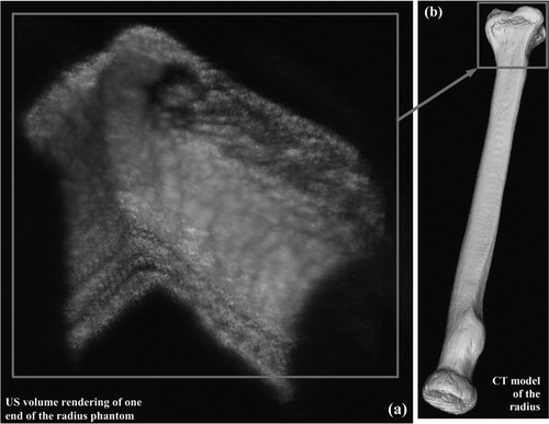 Figure 9. 3D US volume rendering of the distal end of a radius-bone phantom.