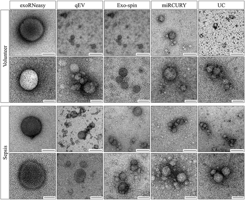 Figure 7. Morphology of serum EVs by transmission electron microscopy. Images are representative for three separate biological replicates for both volunteers (top panel) and sepsis patients (bottom panel). Scale bars are 500 nm (top row) and 100 nm (bottom row).
