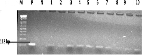 Figure 3. PCR products of the amplification of tuf-gene. M = Molecular ladder (100 bp), lane 1–10 positive isolates. Lane N; negative control