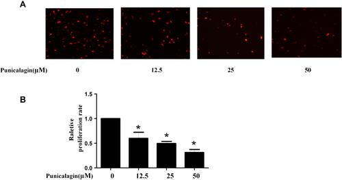 Figure 4 Punicalagin inhibited the cell proliferation of RA FLSs. (A) Cell proliferation was tested by EdU incorporation assays. Representative images show the proliferation of RA FLSs (A) labeled with EdU (red) (original magnification, ×200). (B) The bar represents the relative proliferation rate of RA FLSs. Graphs in A indicated the mean ± SEM of 3 independent experiments involving 6 different RA patients. *P < 0.05 vs control.