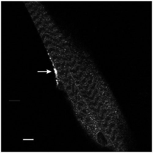 Figure 1. Anti-Myc immunohistochemistry revealed expression of PV at the motor terminal (arrow) innervating muscle fiber 5. This single-plane confocal image passes through the central region of the muscle in segment 3. Calibration: 10 µm.