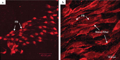 Figure 5. Confocol microscopic images of L929 fibroblast cells grown on the glutaraldehyde-crosslinked collagen fibers (7 days after seeding), staining with (a) PI for nucleus and (b) Rhodamine-Phalloidin for actin filaments. The initial cells’ density was adjusted to 2×104 and seeded on the 10 mg GA-crosslinked collagen fibers.