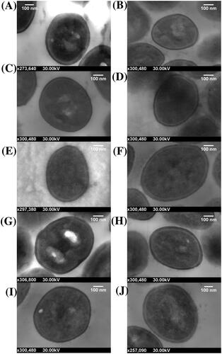 Figure 1. Scanning transmission electron micrographs of S. aureus cells embedded in resin and sectioned on an ultramicrotome. Cells imaged using a Zeiss Merlin FE-SEM at 30 kV and a working distance of 2.7 mm. (A) MSSA 1. (B) MSSA 2. (C) MSSA 4. (D) MSSA 6. (E) MSSA 8. (F) MRSA 1. (G) MRSA 2. (H) MRSA 8. (I) MRSA 9. (J) MRSA 13.