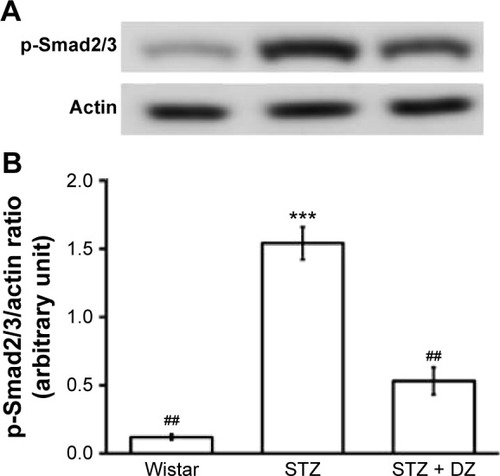 Figure 3 Effect of Du-Zhong on phosphorylated Smad 2/3 level in renal tissues of rats.