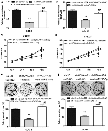 Figure 7. LncRNA HOXA-AS3 promoted OSCC development through regulating miR-218-5p. (a, b) The expression level of HOXA-AS3 in cells co-transfected with sh-HOXA-AS3 and anti-miR-218-5p was detected by qRT-PCR. (c-f) The inhibited proliferation of SCC-9 and CAL-27 cells by HOXA-AS3 knockdown was reversed by anti-miR-218-5p. *P < 0.05, **P < 0.01