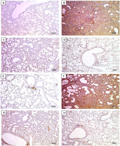 Figure 5. Immunostained lung sections of A) Group I exhibited a negative expression of caspase-3 (0.12%) (×100). B) Group II exhibited a strong positive caspase-3 expression (87.24%) (×100). C) Group III exhibited a weak positive caspase-3 expression (17.14%) (×100). D) Group IV exhibited a weak positive caspase-3 expression (18.16%). E) Group I presented a negative expression of NF-kB (2.63%) (×100). F) Group II exhibited a strong positive NF-kB expression (82.17%) (×100). G) Group III exhibiting a weak positive NF-kB expression (16.25%) (×100). H) Group IV exhibited a weak positive NF-kB expression (18.06%) (×100).