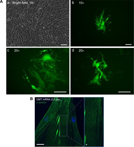 Figure 4 Transfection of GMT mRNAs on cardiac fibroblasts induces expression of cardiomyocyte marker genes and striated cardiac muscle structure.Notes: (A) Fluorescence images of α-MHC promoter-driven GFP expression from GMT mRNA transfected cardiac fibroblasts. α-MHC-GFP cardiac fibroblasts were transfected daily with GMT mRNAs for 7 days and observed with fluorescence microscope. (a, b) Both bright field and green fluorescence images were taken with 10× magnification. (c, d) 20× magnification images were taken from two additional regions. Scale bar is 10 μm. (B) Immunohistochemistry staining of α-actinin in GMT mRNA/C-Lipo transfected cardiac fibroblasts. Inducted cardiomyocyte-like cells express α-actinin and have striated cardiac muscle structure. Scale bar is 2 μm.Abbreviations: GFP, green fluorescence protein; GMT, Gata4, Mef2c, and Tbx5.