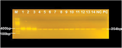 Figure 1. CHIKV RNA detection on agarose gel electrophoresis.