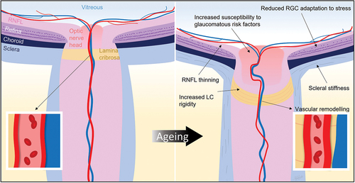 Figure 1. Schematic of normal ageing changes, including biomechanical, vascular and neuronal changes. Understanding how such changes increase the risk of retinal ganglion cell injury may point to novel treatment approaches. RGC, retinal ganglion cell; RNFL, retinal nerve fibre layer; LC, lamina cribrosa.