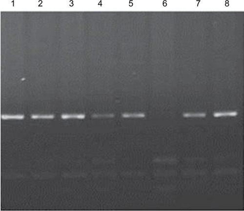 Figure 2 Determination of genotypes for VDR–TaqI polymorphism by using PCR-RFLP method.