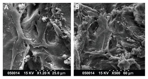 Figure 2 SEM images of PDLSCs on GCF (A) and HGCCS (B).Notes: PDLSCs adhered on the two scaffolds, the cells and regenerated matrices filled in the voids. Cells adapted very closely to the surface and exhibited flattened morphology.Abbreviations: SEM, scanning electron microscopy; GCF, genipin-cross-linked chitosan framework; HGCCS, hydroxyapatite coated genipin-chitosan conjugation scaffold.