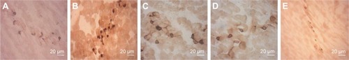 Figure 2 Catalpol improved the state of MEP as determined by AChE staining (200×).