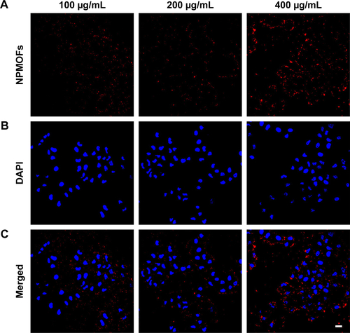 Figure S3 Fluorescence images of NPMOFs in HepG2 cells.Notes: (A) Red signals are from NPMOFs, blue signals are from (B) DAPI staining. (C) Merged images from (A) and (B). Scale bar: 20 µm.Abbreviation: NPMOF, nanoscale gadolinium-porphyrin metal-organic framework.