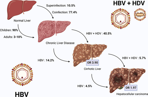 Figure 2 Natural history of HBV and HBV/HDV infected patients. Chronic HBV infection occurs in 90% of infected children and up to 10% of infected adults, while HDV superinfection orcoinfection lead to chronic disease in 10% and 77% of exposed patients, respectively. Compared with HBV mono-infection, HDV/HBV coinfection more frequently leads to liver cirrhosis (OR 3.84), and in a shorter time. The risk of HCC development is increased in both HBV mono-infection and HBV/HDV coinfection (OR 1.66). Image created with Biorender.com.