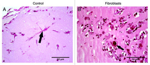 Figure 6. Elastic van Gieson staining identifying fibers such as collagen (pink color). (A) Matrigel implanted without fibroblasts (control), with arrows pointing the track of collagen. (B) Matrigel implanted with fibroblasts, with arrow pointing out the collagen.