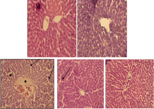 Figure 9 Paraffin sections stained by H&E for histopathological examination of liver tissues of rats as follows: (A) control rats; (B) rats fed with berberine (50 mg/kg, i.g.); (C) rats treated with lead (500 mg Pb/l in the drinking water); (D) rats treated with lead (500 mg Pb/l in the drinking water) and fed with berberine (50 mg/kg, i.g.) and (E) rats treated with lead (500 mg Pb/l in the drinking water) and fed with silymarin (200 mg/kg, i.g.). The long arrow indicates leukocyte infiltration. The short arrow indicates pyknotic nucleus. The dashed arrow indicates hepatic cell necrosis. The asterisk indicates the distended portal vein.