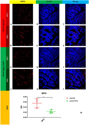 Figure 11. Immunofluorescence map of MPO paraffin sections of rat colon tissue. (A) Showed the immunofluorescence map of MPO in rat colon tissue in the polyHb group(×200). (B) Displays the DAPI image of rat colon tissue in the polyHb group(×200). (C) Presents the combined image of MPO and DAPI in rat colon tissue in the polyHb group(×200). (D) Shows the individual immunofluorescence map of MPO in rat colon tissue in the polyHb group(×400). (E) Displays the DAPI image of rat colon tissue in the polyHb group(×400). (F) Shows the combined image of colon tissue MPO and DAPI in the polyHb group(×400). (G) Presents the immunofluorescence map of MPO alone in rat colon tissue. Colon tissue in the polyCOHb group(×200). (H) Shows the DAPI picture of rat colon tissue in the polyCOHb group (×200). Figure 1 shows the picture of the coincidence of MPO and DAPI in the polyCOHb group(×200). (J) Shows the MPO colon tissue of the polyCOHb group(×400). (K) Shows the DAPI picture of the rat colon tissue in the polyCOHb group(×400). (L) Shows the coincidence of the colon tissue MPO and DAPI of the polyCOHb group (×400). The M plot compares the IOD values of MPO in the colon tissue of two groups of rats(n = 3).