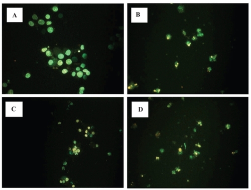 Figure 3 Effects of LOX inhibitor in induction of apoptosis on RCC cells. Human RCC cell line (Caki-1) treated with 5-LOX inhibitor caffeic acid (B), and nonspecific LOX inhibitor NDGA (D) showed chromatin condensation, cellular shrinkage, small membrane-bound bodies (apoptotic bodies), and cytoplasmic condensation. Cells with 12-LOX inhibitor baicalein only slightly showed the same apoptotic changes (C). In contrast, untreated cells (A) maintained normal chromatin patterns and cell size.