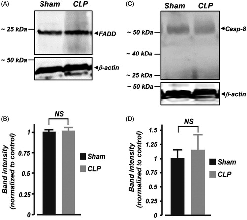 Figure 4. Early polymicrobial sepsis does not alter protein expression of FADD and caspase-8 in neonatal pig kidney cortex. (A and C) Western immunoblot images, (B and D) Mean data demonstrating protein expression levels of FADD and caspase (Casp; ∼55 kDa)-8 in kidney cortex isolated from sham-operated and septic neonatal pigs (6 h; n = 4 each). Smaller protein fragments representing active caspase-8 were not observed in the samples. NS: not significant.