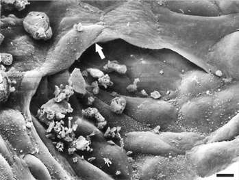 FIG. 5 SEM showing the inner aspect of Bowman's capsule. Note a fold at the opening of the proximal tubule (arrow). Bar = 13 μm.