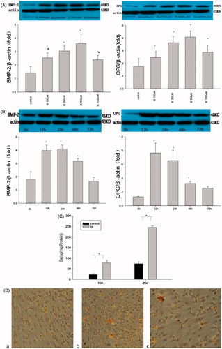 Figure 1. Effects of IS on osteoblast differentiation and calcification of VSMCs. (A) VSMCs were incubated with various concentrations of IS for 24 h. (B) VSMCs were incubated with 500 μM IS for different durations. Top panels: representative western blots of BMP-2 and OPG. Graphs: quantification of the expression. (C) VSMCs were incubated with or without 500 μM IS for 10 or 20 days. (D) Alizarin Red S staining. The arrows point to calcium nodes. a: VSMCs were incubated for 14days. b: VSMCs were incubated for 14 days with 500 μM IS. c: VSMCs were incubated with IS and phosphonoformic acid (PFA). Results are presented as percentage of control values and are mean ± SD of three independent experiments. *p < 0.05, compared with the control group. #p < 0.05, compared with the 500 μM IS-stimulated group.