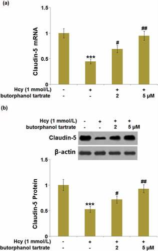 Figure 6. Effects of butorphanol tartrate on the expressions of Claudin-5 in Hcy-treated HBVECs. Cells were treated with Hcy (1 mmol/L) in the presence or absence of butorphanol tartrate (2 µM, 5 µM) for 24 hours. (a) mRNA Levels of Claudin-5 were determined; (b) Protein levels of Claudin-5 were determined (***, P < 0.001 vs. Control group; #, ##, P < 0.05, 0.01 vs. Hcy group).