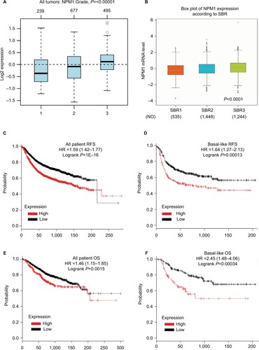 Figure 6 The prognostic values of NPM1 in breast cancer patients.Notes: (A) NPM1 expression in breast cancer tissues of different histological grades. (B) NPM1 expression in breast cancer tissues of different SBR grade status. (C and E) High mRNA level of NPM1 was significantly associated with poorer OS and RFS in all BC patients. (D and F) Elevated NPM1 mRNA level was significantly associated with shorter RFS and OS in all BC patients in Basal-like subtype BC patients.Abbreviations: BC, breast cancer; HR, hormone receptor; OS, overall survival; RFS, recurrence-free survival; SBR, Scarff Bloom and Richardson.