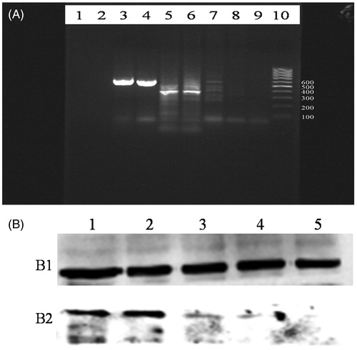 Figure 4. The expression of survivin in local vascular injury site. (A) Relative levels of mRNAs encoding survivin expression. Lane 1, blank control. Lane 2, the normal control group, no survivin mRNA expression. Lanes 3 and 4 were β-actin. Lanes 5 and 6 is 28 and 14 d after vascular injury in group without treatment, respectively, these are survivin mRNA expression. Lane 7 is 7 d after vascular injury in group without treatment, no survivin mRNA expression. Lanes 8 and 9 is 28 and 14 d after vascular injury in groups with atorvastatin treatment, respectively, no survivin mRNA expression. Lane 10, marker. (B) Relative level of survivin expression was analyzed by Western blotting. (B1) Tubulin, as an internal standard; (B2) survivin protein. Lanes 1, 2, and 3 are 28, 14, and 7  d after vascular injury in group without treatment, respectively. Lanes 4 and 5 are 28 and 14 d after vascular injury in group with atorvastatin treatment. Survivin expression is similar to the survivin mRNA.