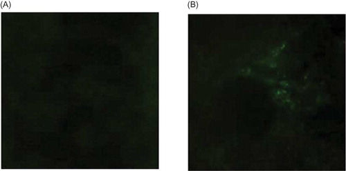 Figure 3. Detection of fluorescence microscopy. (A) No green fluorescence appeared after NC-siRNA-PEI injection. (B) The green fluorescence around the renal tubular was seen after FAM-siRNA-PEI injection.