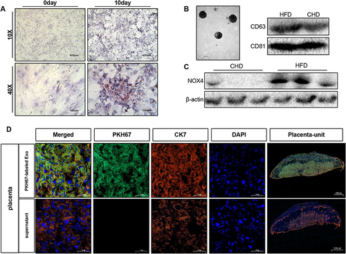 Figure 8 Adipocyte-derived exosome can be delivered to placenta in vivo. (A) Primary mouse adipocytes and induced differentiation for 10 days were stained with oil red O, scale bar: 400µm and 100µm. (B) Identification of mouse adipocyte-derived exosomes. Electron microscope, scale bar: 200nm. Western blot was used to detect CD63 and CD81. (C). Detection of NOX4 protein expression in exosomes, n=3 in each group. (D). Confocal microscopy showing green (PKH67), red (CK7), blue (DAPI) fluorescence and merged images of mouse placenta, after injected PKH67–labeled exosome or its supernatant for 24h, scale bar: 1000µm. Data are presented as mean ± SEM. Student’s t-test. All experiments were performed in triplicate.