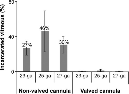 Figure 8 Vitreous incarceration in porcine cadaver eyes.