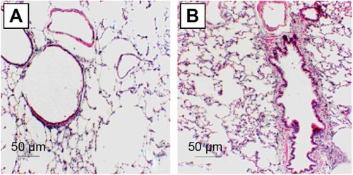 Figure 1 Histology of the rat lung tissues from control animal and COPD model.