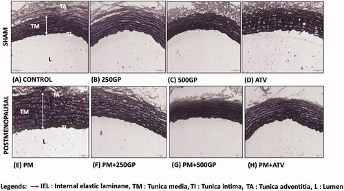 Figure 2. Photomicrograph showing the section of aortic tissues in (A) Control; (B) 250GP; (C) 500GP; (D) ATV; (E) postmenopausal (PM); (F) PM + 250GP; (G) PM + 500GP and (H) PM + ATV after 6 months of supplementation where TI: tunica intima, TM: tunica media, TA: tunica adventitia and L: lumen under Verhoeff-Van Gieson stain. (LM × 40).