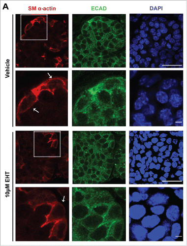 FIGURE 5. Rac GTPase Inhibition Disrupts the Morphogenesis and Differentiation of the Myoepithelium in the Developing SMG. (A) ICC for SM α-actin (red) and ECAD (green) with DAPI staining (blue) performed on E13 SMGs treated with 10µM EHT for 96 hours shows that the SM α-actin+ cells undergo a vertical compression after 96 hrs culture relative to the glands that were treated with EHT. Scale bar, 10µm (rows 1 and 3) and 2µm (rows 2 and 4). (B) The cell height (µm) of individual ECAD+/SM α-actin+ epithelial cells was quantified in glands treated with or without 10µM EHT for 96 hours. The height of these cells in the EHT-treated glands was significantly greater than in the control glands (***p ≤ 0.001, n = 45). (C) The number of SM α-actin+ cells within an epithelial ROI (n ≥ 35) was significantly decreased following EHT treatment when compared to controls (****p < 0.0001). (D-E) Representative western analysis and quantification (n ≤ 3) performed on whole E13 glands following 96-hour culture +/− EHT treatment indicated a decrease of approximately 40% in SM α-actin levels in EHT-treated relative to control glands.