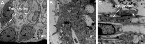 Figure 6 TEM image of (A) normal, (B) treated with BO-SLN/CM, and (C) treated with fresh DMEM in vitro BBB model.Abbreviations: BBB, blood–brain model; BO-SLN/CM, borneol-modified chemically solid lipid nanoparticle; DMEM, Dulbecco’s Modified Eagle’s Medium; TEM, transmission electron microscopy.
