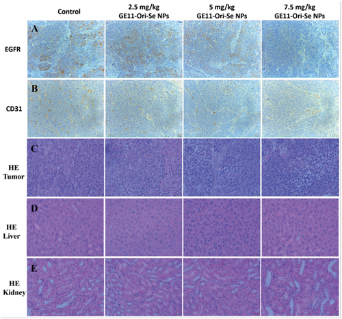 Figure 10. Immunohistochemical analysis of tumor, liver, and kidney from GE11-Ori-Se NPs treated mice. Immunohistochemical analysis of tumor sections from GE11-Ori-Se NPs treated mice by (A) EGFR staining, (B) CD31 staining, and (C) HE staining. HE staining analysis of (D) liver and (E) kidney from GE11-Ori-Se NPs treated mice.