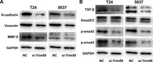 Figure 4 Effect of si-Trim59 on EMT and TGF-β/Smad2/3 signaling pathway of Bca cell lines.