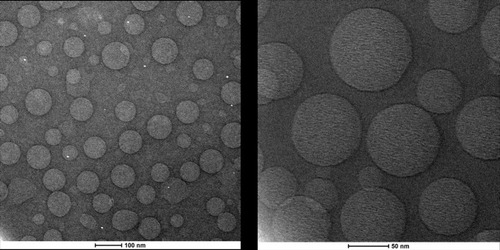 Figure 1 Cryo-TEM analysis of CoQ10-loaded O/W NEs at different magnification. TEM, transmission electron microscope.Abbreviations: CoQ10, Coenzyme Q10; O/W, oil in water; NEs, nanoemulsions.