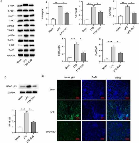 Figure 6. The regulatory role of CaD in LPS-induced activation of NF-κB. (a) The phosphorylation and total levels of PI3K, AKT, IKKβ, IKBα, p65 in kidney sections in various groups were detected by using Western blot analysis. (b) NF-κB p65 nuclear translocation levels in kidneys were determined using Western blot analysis. (c) Representative images showing the nuclear translocation of NF-κB p65 in kidneys. N = 10 in each group. *p  <  0.05; **p  <  0.01; ***p  <  0.001.