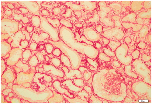 Figure 1. Sirius Red stained interstitial space, normal light microscopy appearance.