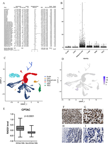 Figure 3 The expression pattern of RAD21 in liver cancer. (A) The random forest plot illustrates a significant overexpression of RAD21 in HCC. (B-E) Single-cell sequencing analysis reveals that RAD21 expression is primarily distributed in tumor cells. (E) Proteomics analysis demonstrates significantly higher levels of RAD21 protein in HCC compared to adjacent normal tissue. (F and G) The RAD21 staining in HCC tissues was observed under the microscope (x40, x100). (H and I) The RAD21 staining in HCC and liver tissues was observed under the microscope (x40, x100).