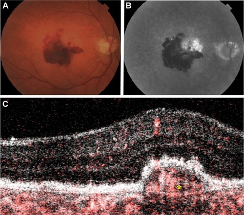 Figure 1 Clinical imaging for Case 1.